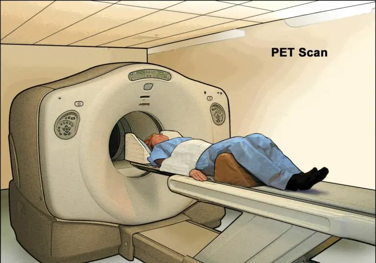 치매-PET-CT-이미지